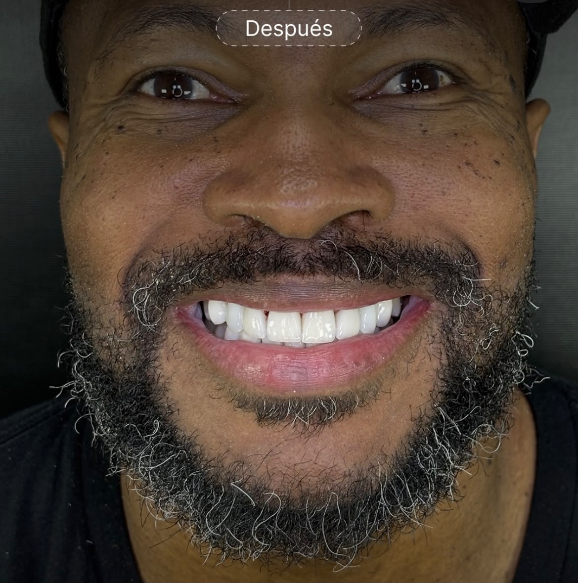 Después del tratamiento