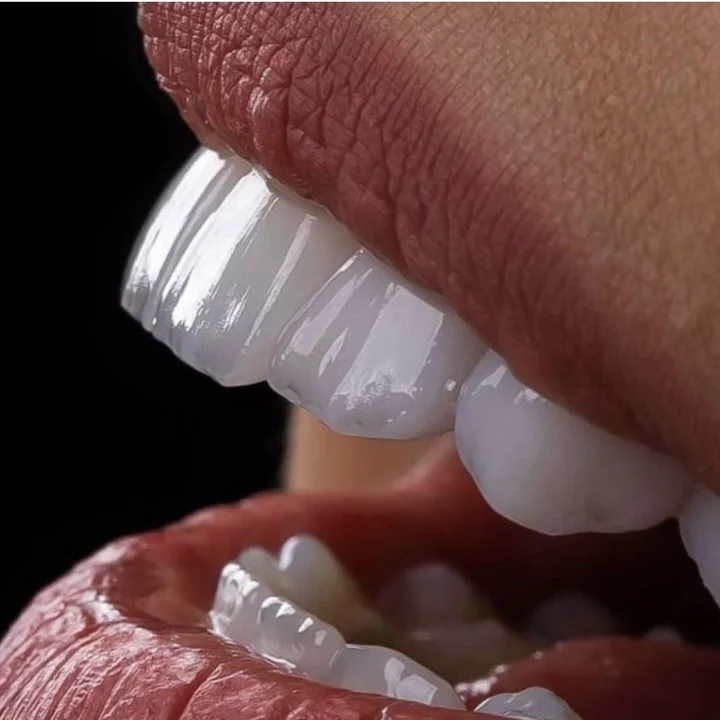 Sonrisa con carillas de porcelana de Smile From Medellín